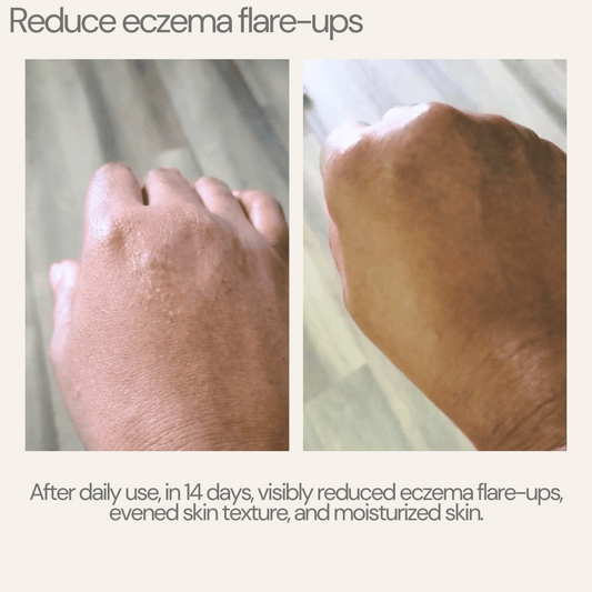 Stress Relief: Spearmint Eucalyptus Soap