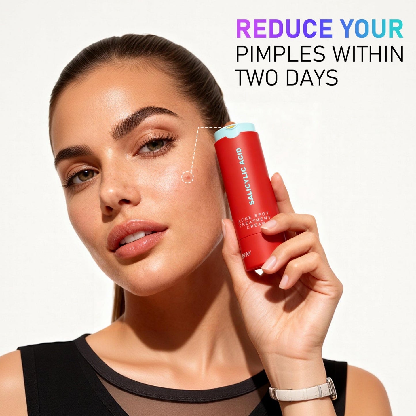 Phofay Acne Removing Lotion