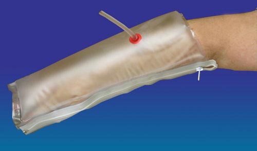 Inflatable Half-Arm Splint 25 - Transparent Vinyl, Immobilizing Orthopedic Support