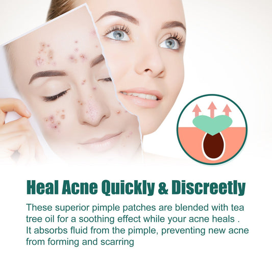 EELHOE Love Acne Patch Gentle Cleansing Acne Patch Fades Facial Acne Marks And Spots Facial Cleansing Care
