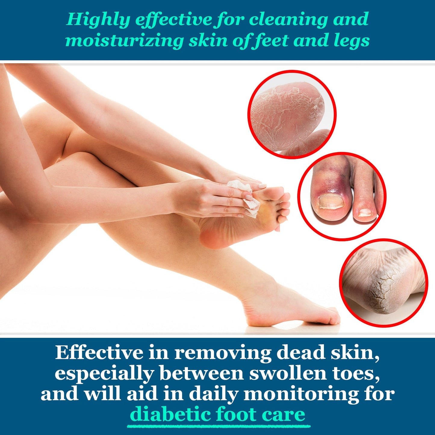 pHeet® Antifungal & Antibacterial Foot Wipes
