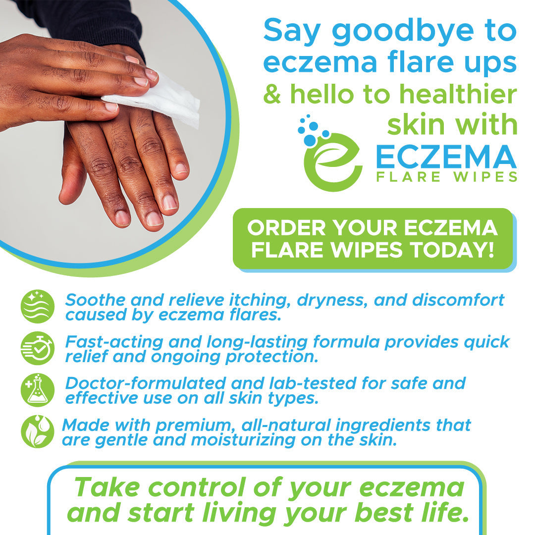 Eczema Flare Wipes®