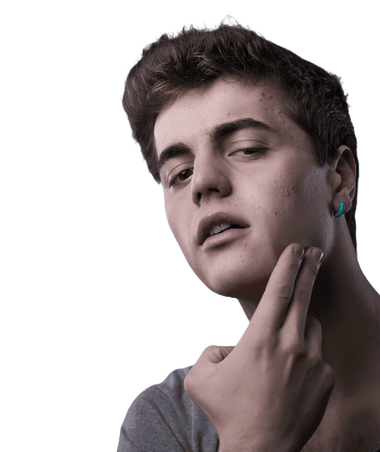 Organic Anti-Acne Facial Moisturizer - FOR MEN