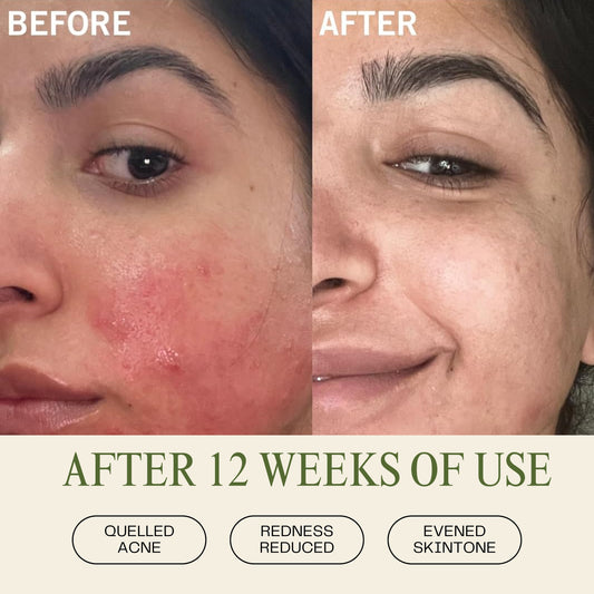 Pineapple & Rosehip Vitamin C Serum