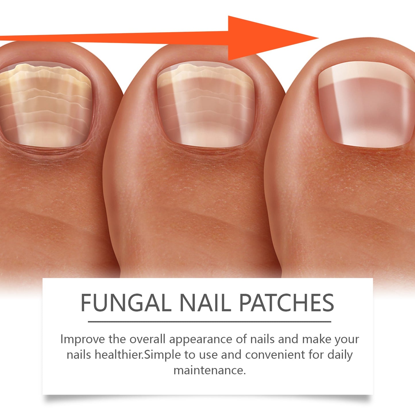 Ximonth Nail Care Patches Gently Repair Nails For Easy Daily Cleaning With Simple Care Patches