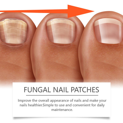 Ximonth Nail Care Patches Gently Repair Nails For Easy Daily Cleaning With Simple Care Patches