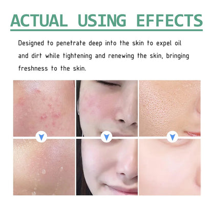 Hoygi Green Tea Cleansing Mud Mask, Facial Cleansing Moisturizing Whitening Skin Blackhead Acne Removing Mud Mask