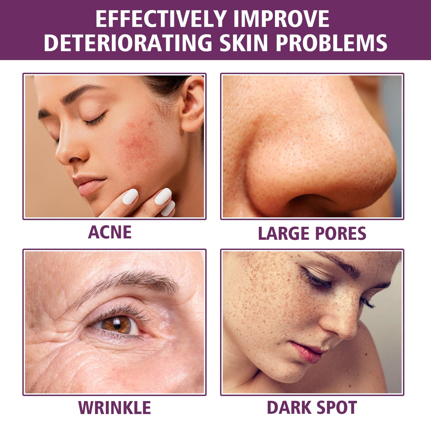 EELHOE Niacinamide Serum, Skincare Lifting Spot-Blemishing And Anti-Wrinkle Serum