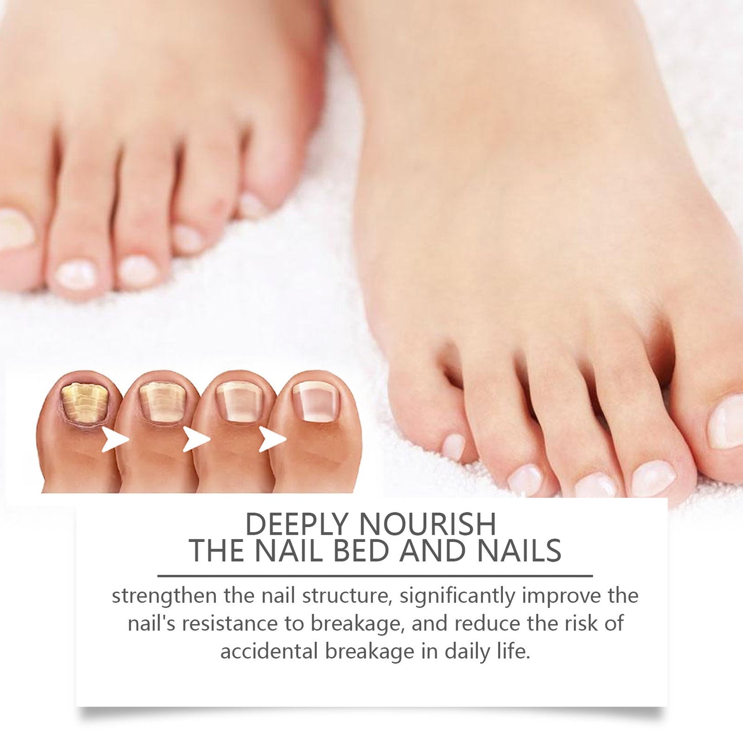 West&Month Nail Repair Solution, Hand And Foot Nail Cleaning Care Gentle Moisturizing And Moisturizing Nail Repair Solution