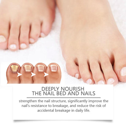 West&Month Nail Repair Solution, Hand And Foot Nail Cleaning Care Gentle Moisturizing And Moisturizing Nail Repair Solution