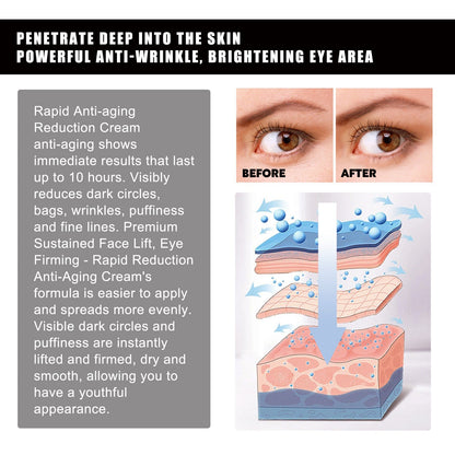 Hoygi Strawberry Gel Patch Reduces Fine Lines Under Eyes, Bags Under Eyes, Dark Circles, Firming Eyes, Anti-Wrinkle Moisturizing Eye Patch