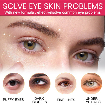 EELHOE Eye Cream, Reduce Pouch Black Rim Of The Eye Brighten The Skin Moisturizing Eye Anti Aging