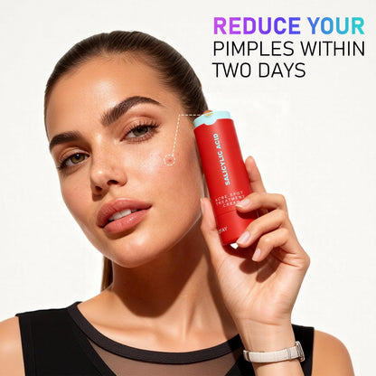 Phofay Acne Removing Lotion