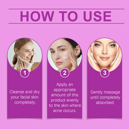 West&Month Azelaic Acid Cream Daily Acne Gentle Cleansing And Repair Skin Smooth And Moisturizing Cream