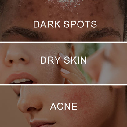 West&Month Retinol Pigment Correcting Spray, Lightening Spots Moisturizing Whitening Skin Care Spray
