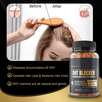 Blocking Agent Soft Candy Hair 60 Capsules DHT Soft Candy