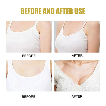 Ginger Papaya Breast Enhancement Patch, Firming Lifting Bust Care Stickers For Fuller Plump Chest, 10 Pcs
