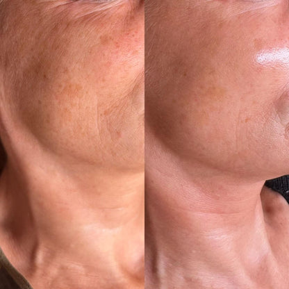 Elixir Serum - 24k Gold Ceramides Niacinamide Vitamin C