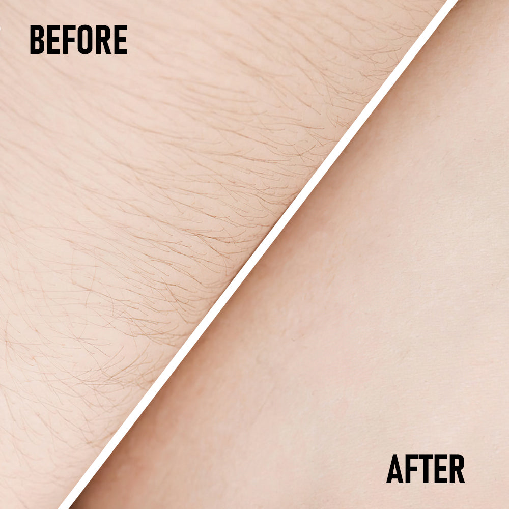 Phofay pain free hairs removal cream