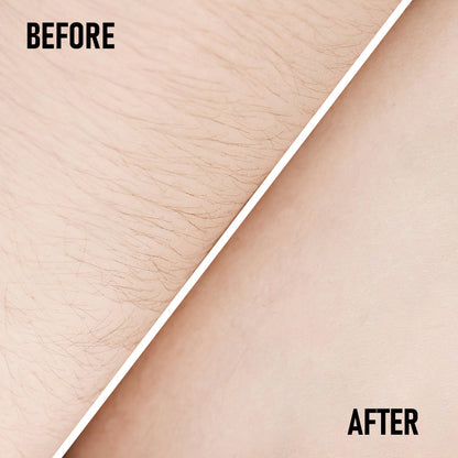 Phofay pain free hairs removal cream