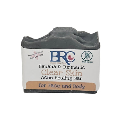 Ultimate Clear Skin Acne Healing Facial Bundle with Free Healing Cleansing Bar