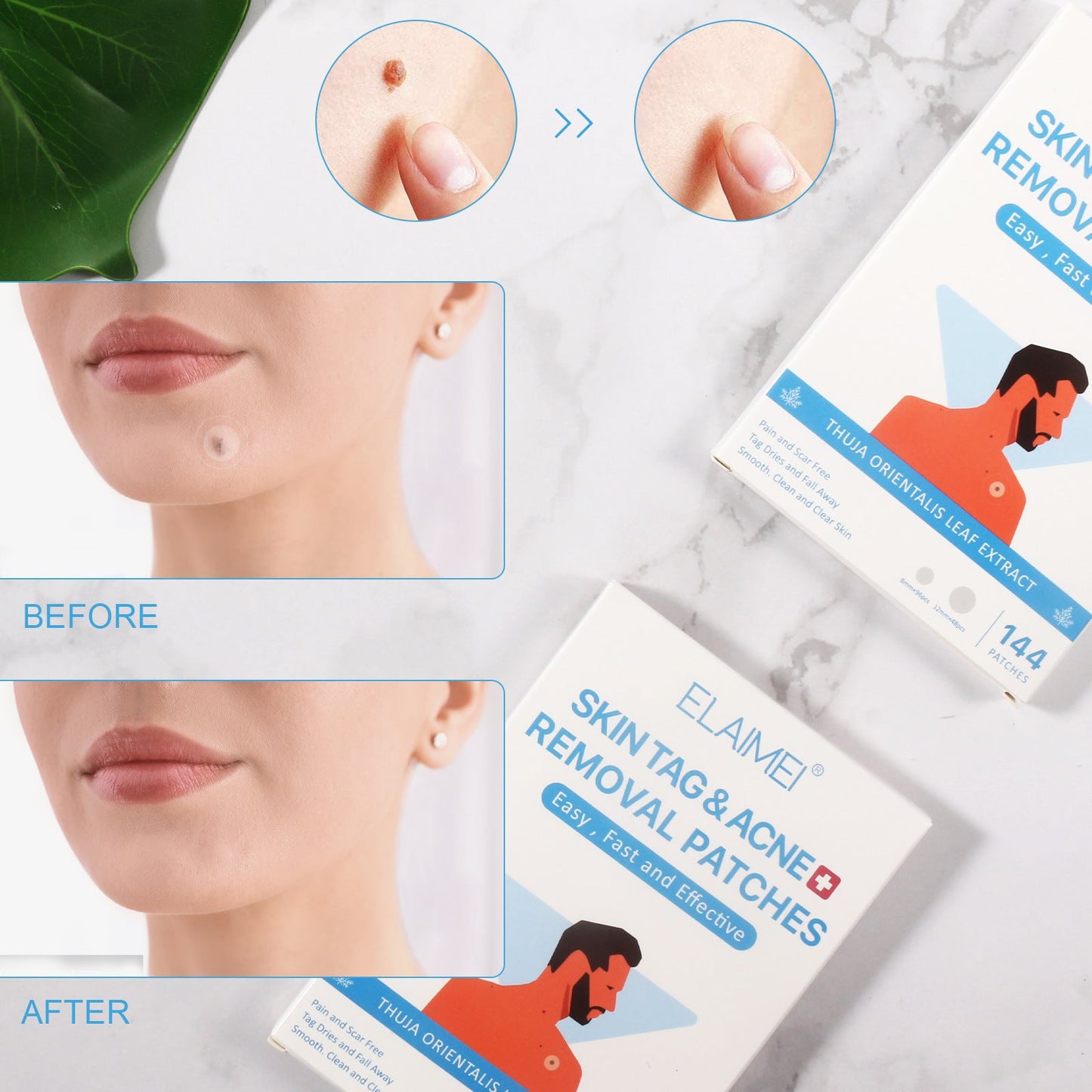 New Skin Tag Remover Patches Skin Tag Remover Pads Covers Conceals Skin Tags Mole Wart Removal Patches Fast Deliver