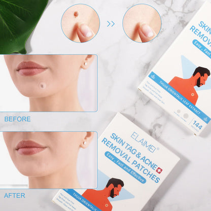 New Skin Tag Remover Patches Skin Tag Remover Pads Covers Conceals Skin Tags Mole Wart Removal Patches Fast Deliver