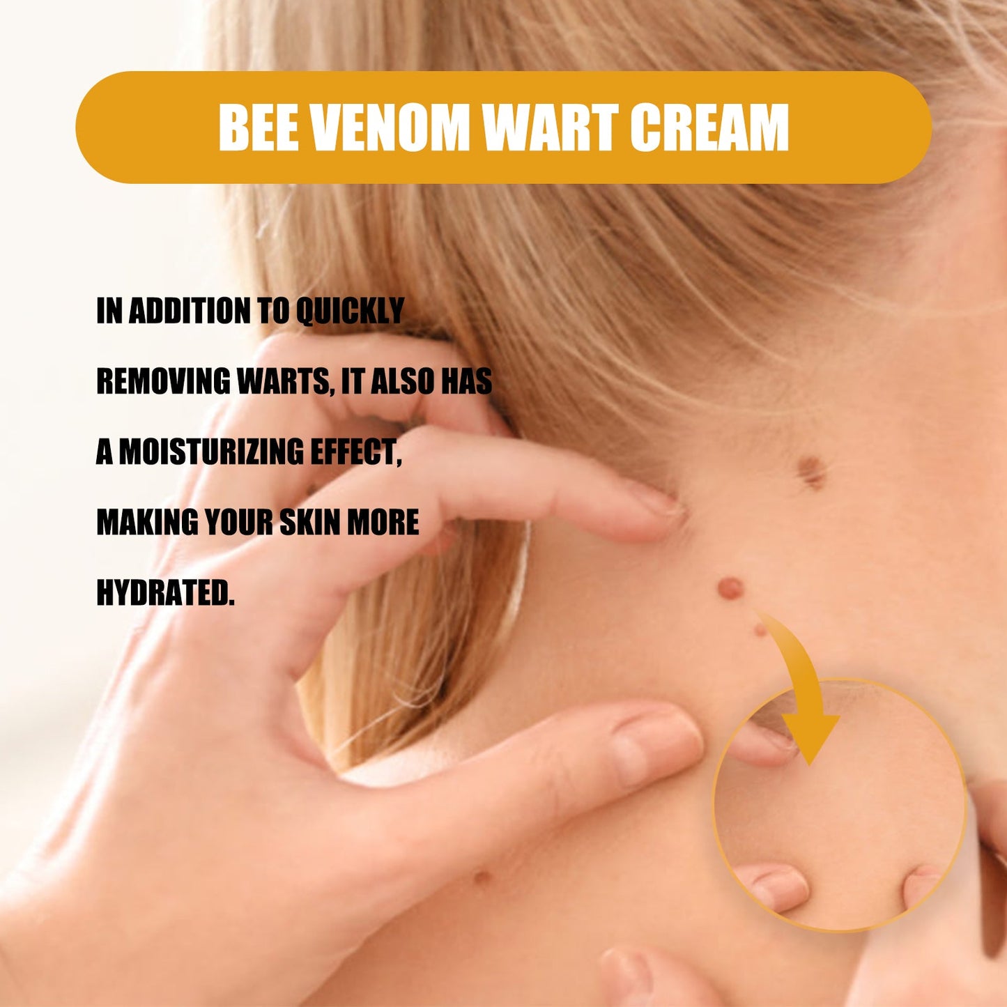 Ximonth Bee Venom Wart Cream, Repair Smooth Skin Lightening Nevus Spot Nevus Cure Wart Care Cream