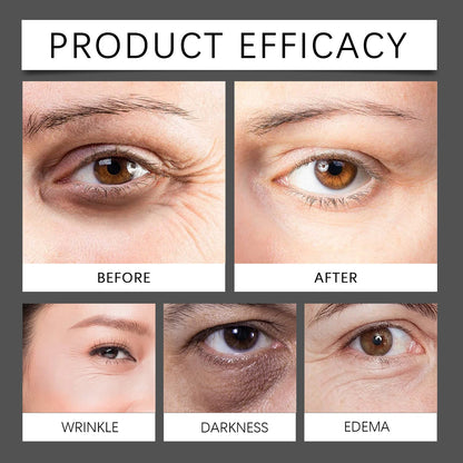OUHOE Micro-Minerals Eye Fat Diminishing Cream, Eye To Butter Cream Moisturizing Anti-Wrinkle Bust Firming Moisturizing Eye Creams