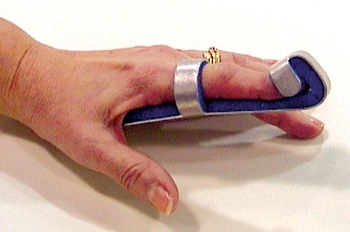 Baseball Finger Splint Small Bulk PK/6 - Distal Phalanx Fracture Support