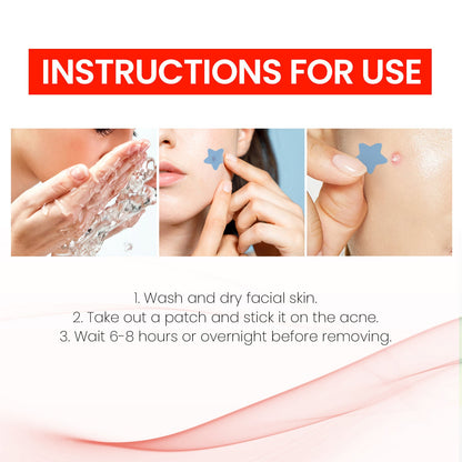 Repair Acne Patch,200patches
