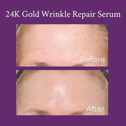 24K Gold Caviar Wrinkle Repair Serum