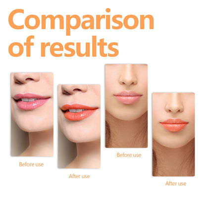 EELHOE Changing Lip Oil, Mildly Removes The Lips Cutin Plentiful Full Fine Light Zerun Lip Oil