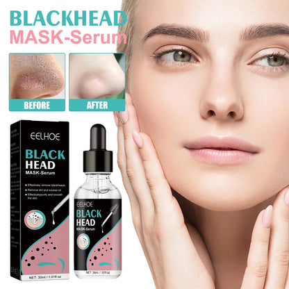 EELHOE Blackhead Nose Mask Moisturizes And Smoothes The Skin, Removes Blackheads From Acne And Deeply Cleans Pores And Dirt