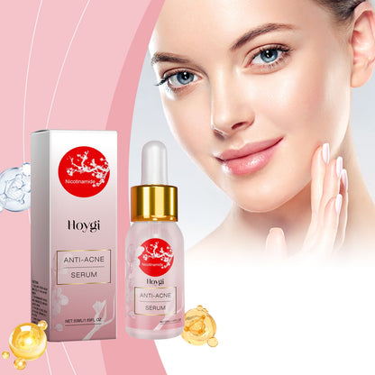 Hoygi Nicotinamide Anti-Acne Serum Mild Anti-Acne Serum Improve Acne Moisturizing Repair Serum