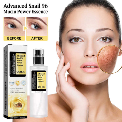 OUHOE Snail 96 Collagen Power Essence, Repair Skin Barrier Moisturizing And Fading Dark Spots Snail Essence
