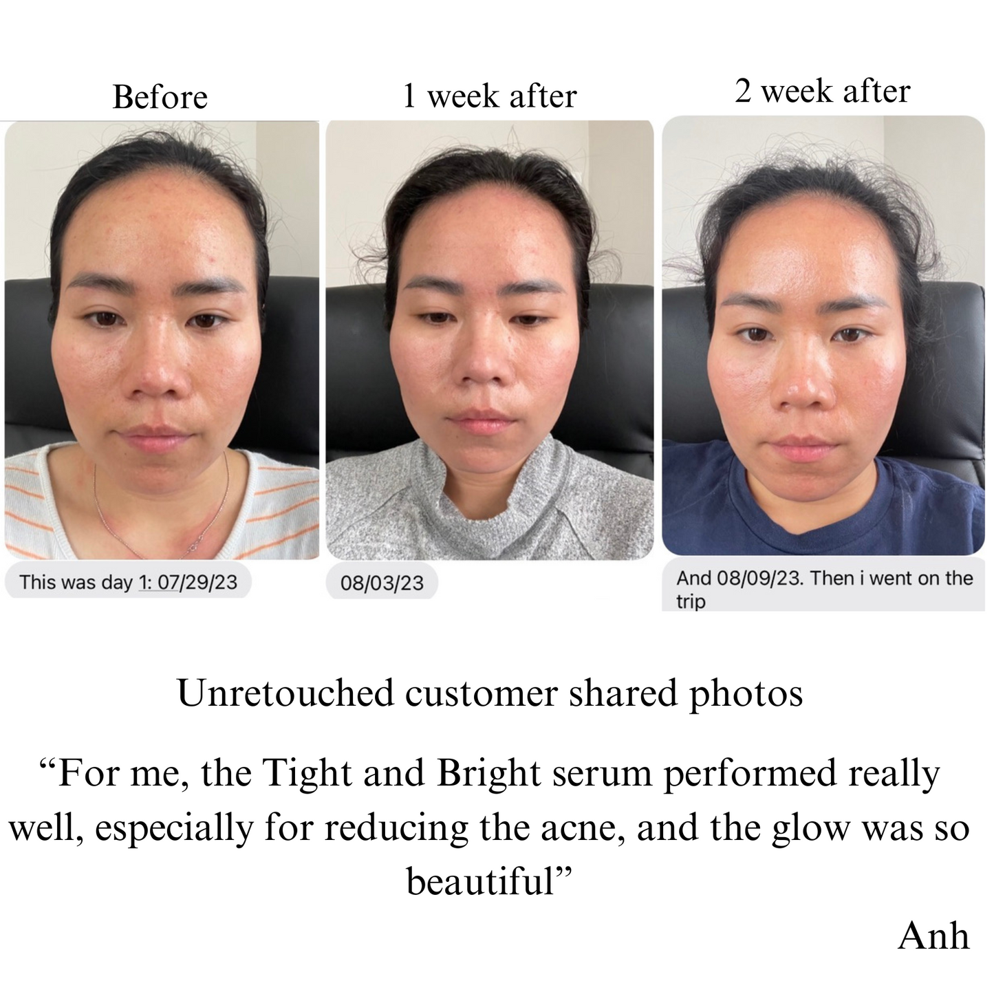 TIGHT AND BRIGHT, an Advanced Gentle Phyto-Retinol and Vitamin C Serum, 12 Innovative Technologies, 55% High-Performance Cosmeceuticals