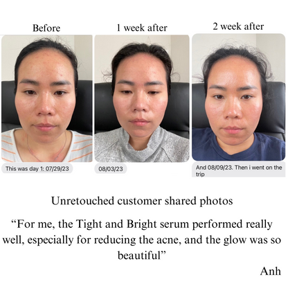 TIGHT AND BRIGHT, an Advanced Gentle Phyto-Retinol and Vitamin C Serum, 12 Innovative Technologies, 55% High-Performance Cosmeceuticals