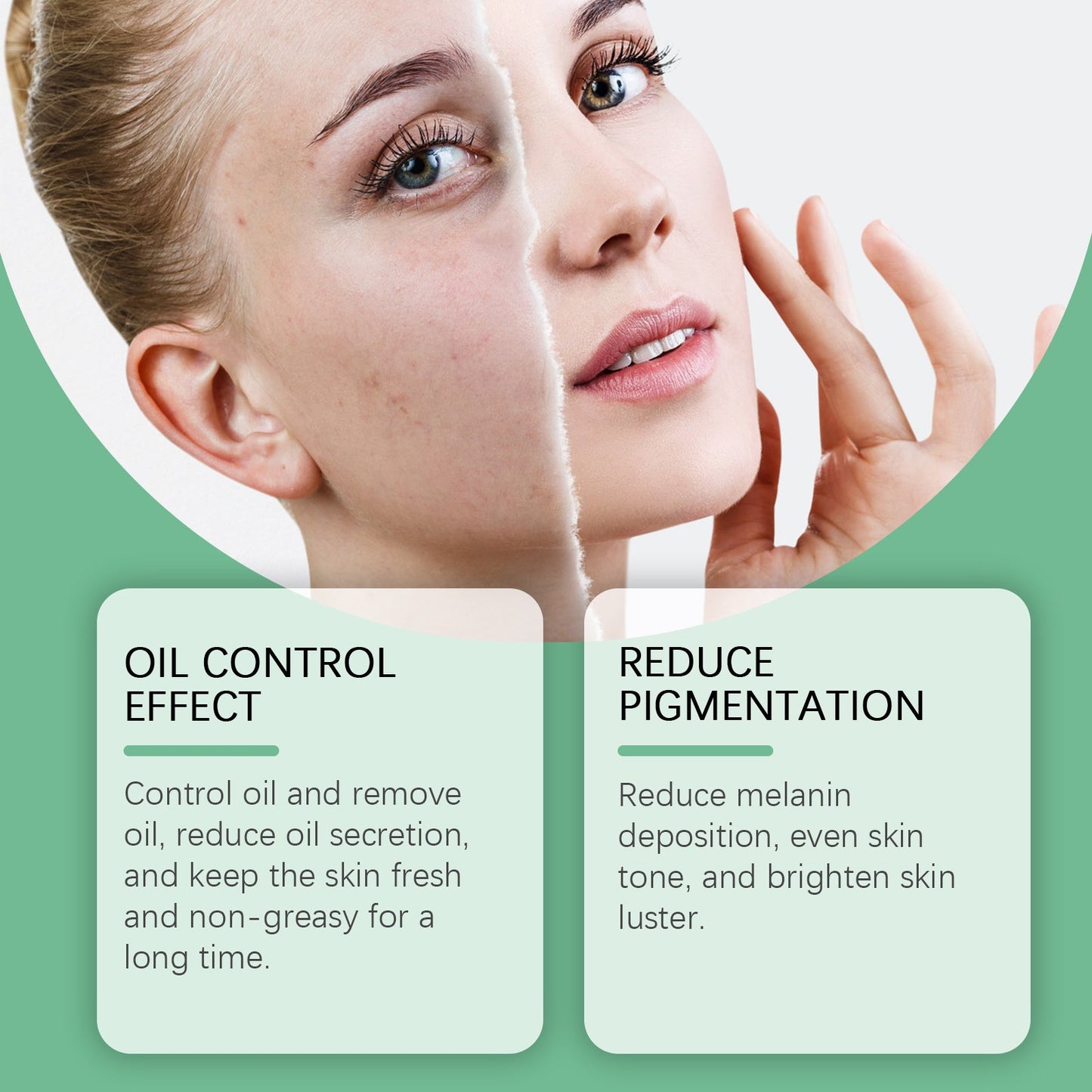 West&Month Azelaic Acid Essence Cream, Repair Moisturizing Moisturizing Face Oil Control Moisturizing Mild Refreshing Cream