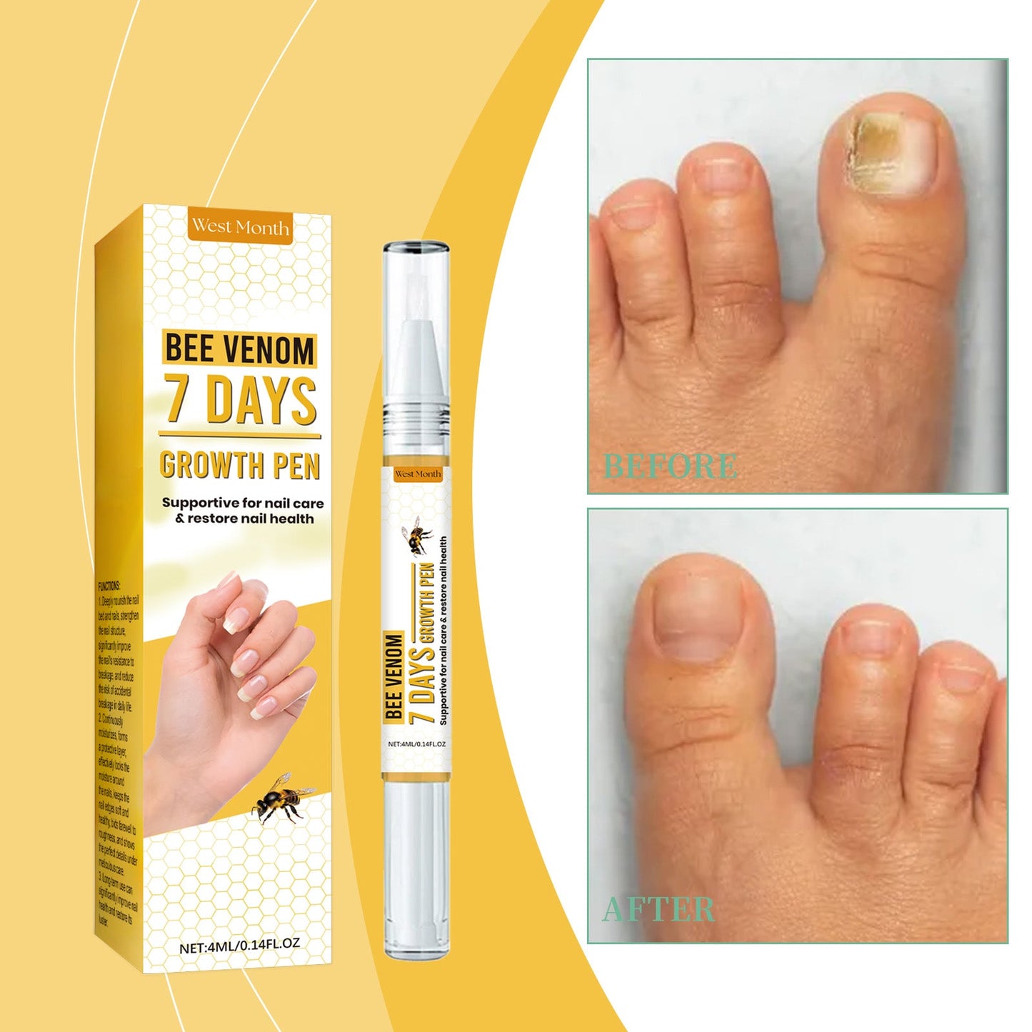 West&Month Nail Repair Solution, Hand And Foot Nail Cleaning Care Gentle Moisturizing And Moisturizing Nail Repair Solution