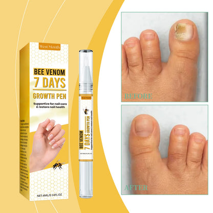 West&Month Nail Repair Solution, Hand And Foot Nail Cleaning Care Gentle Moisturizing And Moisturizing Nail Repair Solution
