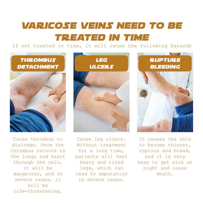 Ximonth Vein Renewal Smooth Legs Cream, Relief Sore Legs Massage Varicose Earthworm Leg Vein Care Cream