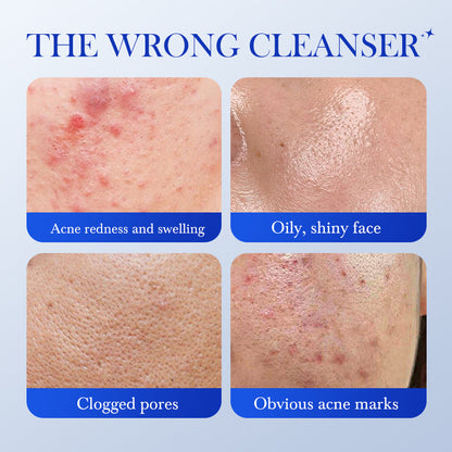 HUNMUI Salicylic Acid Acne-Fighting Facial Cleanser