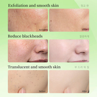 Gongpei Whitening Exfoliating Gel 60g