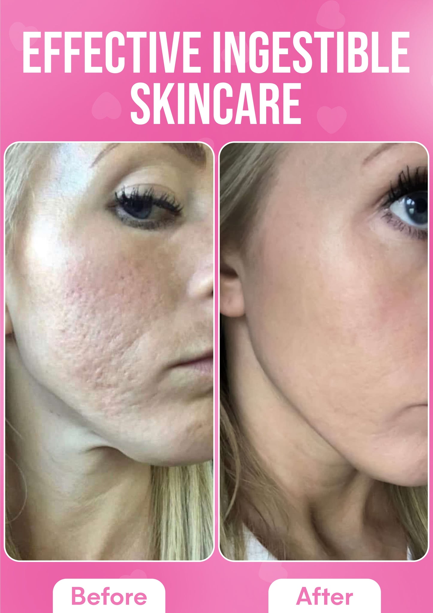 It Girl Skin – Ceramide, Hyaluronic Acid & Beauty Gummies for Glowing Skin