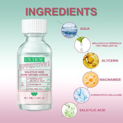 OUHOE Salicylic Acid Acne Lotion Gently Cares For Acne-Prone Skin, Refines Pores And Moisturizes Facial Skin