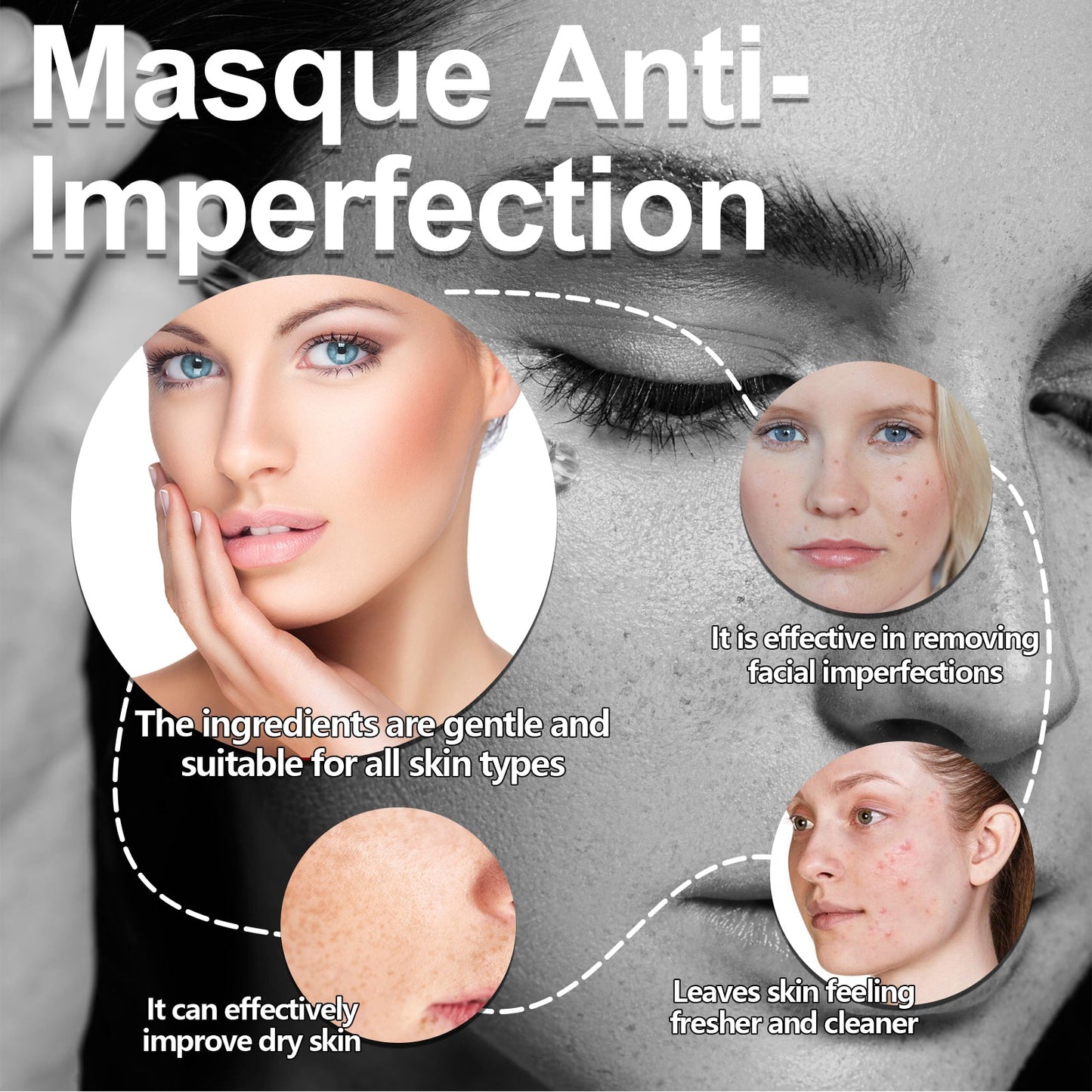 West Month Masque Anti-Imperfection, Clean And Repair Acne Seal Oil Control Solid Mask