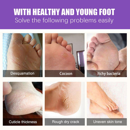 EELHOE Ginger Foot Mask (Bag) Foot Moisturizing, Nourishing, Rejuvenating, Exfoliating, Removing Dead Skin, Dry And Cracked Skin Care Foot Mask