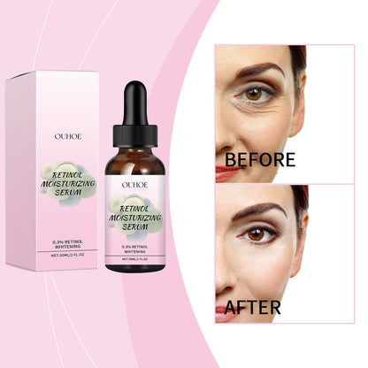 OUHOE Retinol Hydrating Serum, A Delicate And Moisturizing Face Anti-Wrinkle Serum With Retinol Vitamin C