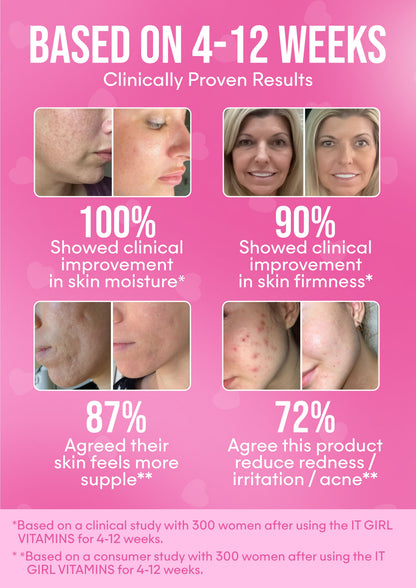 It Girl Skin – Ceramide, Hyaluronic Acid & Beauty Gummies for Glowing Skin